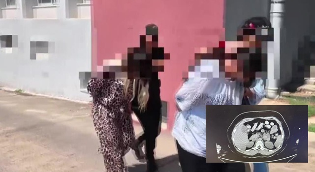 Polisten operasyon: İki kadın kuryenin midesinden 1,5 kilo uyuşturucu çıktı