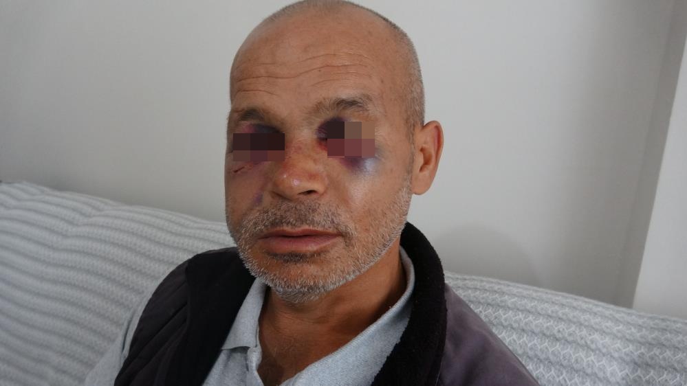 Engelli adamı darbeden şüpheli serbest bırakıldı