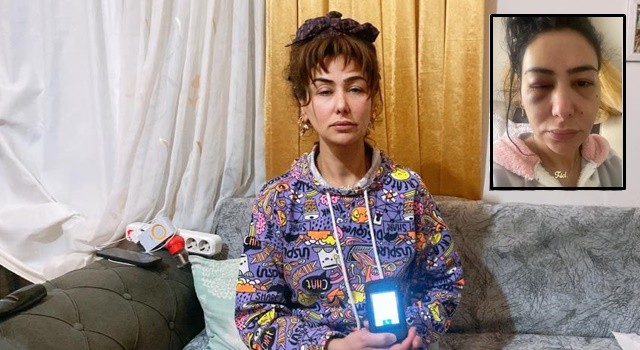 'DARP EDENE ELEKTRONİK KELEPÇE, DAYAK YİYENE PANİK BUTONU