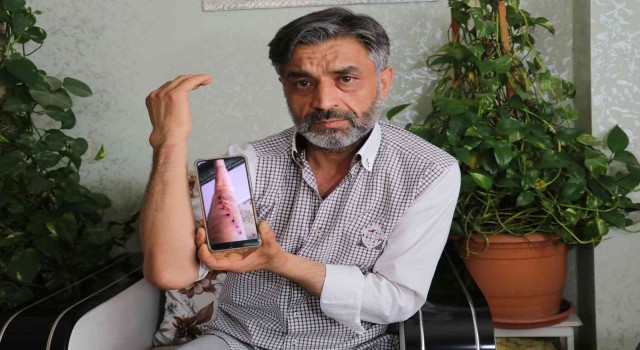 Seyhan Devlet Hastanesinde "ameliyat" skandalı