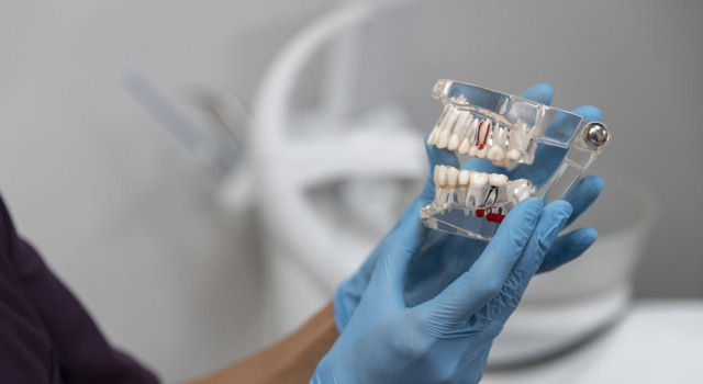 Ağız ve Diş Sağlığınızı İhmal Etmeyin