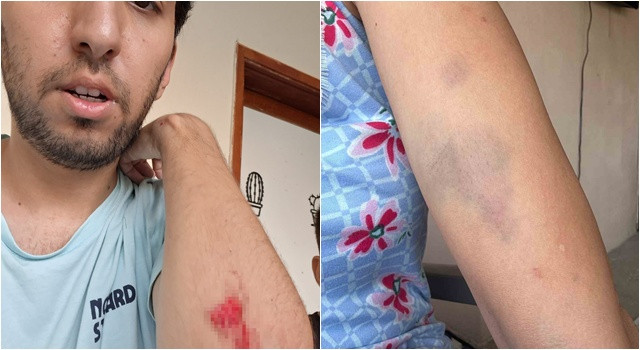 Akçatekir'de 'Köpek Besledin' dayağı iddiası