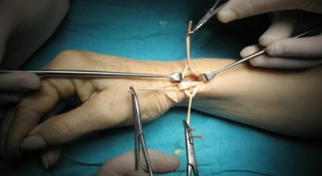 El Cerrahisi & Mikro Cerrahi: Uzman Ellerle Hayata Dokunan Cerrahi Sanatı