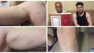 "Gazi polise karakolda işkence " iddiası